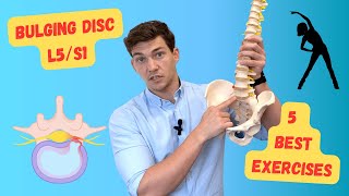 Bulging Disc L5S1 The 5 Best Exercises Explained in Detail [upl. by Terry76]