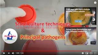 Stool culture techniques for isolation of enteric pathogens like Salmonella Shigella and Vibrio [upl. by Ruon]