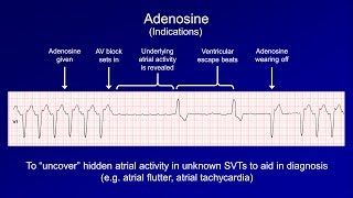 Antiarrhythmics Lesson 6  Digoxin Adenosine Atropine Isoproterenol and Ivabradine [upl. by Revert]