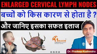 Enlarged cervical lymph nodes treatment  Cervical lymph nodes in child  lymphadenitis [upl. by Elda]