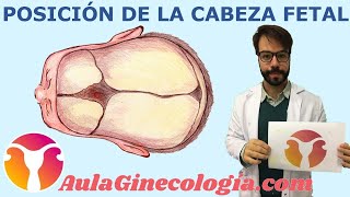 POSICIÓN de la CABEZA FETAL durante el PARTO  Ginecología y Obstetricia [upl. by Eittol]