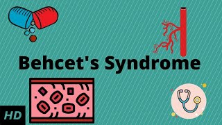 Behcets Syndrome Causes Signs and Symptoms Diagnosis and Treatment [upl. by Sudderth]