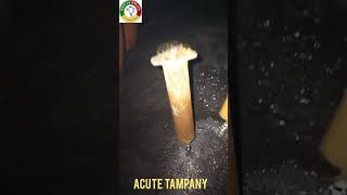 Acute Tempany in Buffalo buffalovideo veterinary veterinarymedicine veterinary cowmilk [upl. by Ecille639]