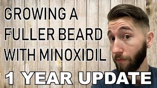 Minoxidil Beard  1 Year  Before and After Pic [upl. by Nysa17]