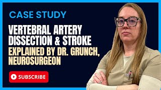 Case study 29  Vertebral Artery Dissection EXPLAINED by a neurosurgeon [upl. by Adran596]