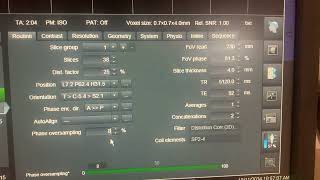 IncreasingDecrease Phase Oversampling in MRI while Scanning [upl. by Dawn159]