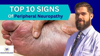 TOP 10 SIGNS of Peripheral Neuropathy Bonus at End [upl. by Eissert]