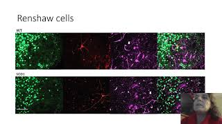 Inhibitory interneurons show early dysfunction in a SOD1 [upl. by Talmud]