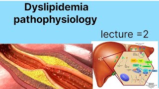 Pathophysiology of hyper dyslipidemia  dyslipidemia types and causes  hypercholesteolemia [upl. by Ila]