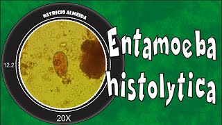 Entamoeba histolyticadispar [upl. by Coulson]