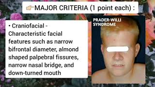 Prader Willi Syndrome Genetics Symptoms and Diagnosis [upl. by Eniluqcaj611]