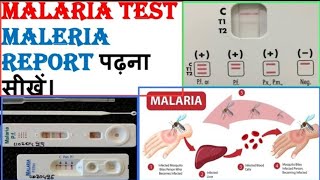 मलेरिया रिपोर्ट की जांच कैसे करें  Malaria Test Report  Malaria Symptoms  Malaria Treatment [upl. by Petey508]