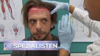 Schwerwiegende Folgen nach Haartransplantation  Auf Streife  Die Spezialisten  SAT1 TV [upl. by Anirad]