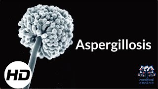 Aspergillosis Everything You Need To Know [upl. by Anolla779]