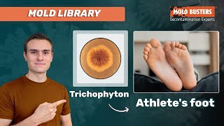 Trichophyton 🦠  📚Mold Library  Mold Busters [upl. by Attelra815]