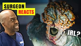 Could The Last Of Us Happen IRL Surgeon Reacts To Cordyceps Infection amp Zombie Fungus [upl. by Nerro984]