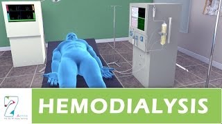 Hemodialysis [upl. by Onavlis]