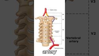 Vertebral Artery Dissection [upl. by Esej]