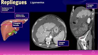 2 Cavidad peritoneal mesenterio y pared abdominal [upl. by Arras]