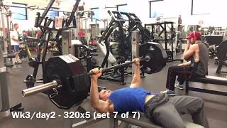 BENCH PRESS ACCIDENT  EMERGENCY ROOM  Smolov Jr wk3  Gym FAIL [upl. by Ignaz]