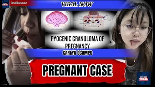 Carlyn ocampo pregnant case [upl. by Loginov645]