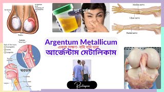 12 Argentum Met l আর্জেন্টাম মেটালিকাম l মেটেরিয়া মেডিকা l Materia Medica l Learn Argentum Met [upl. by Anstice]