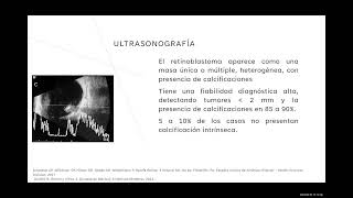 Retinoblastoma y Facomatosis [upl. by Estella]