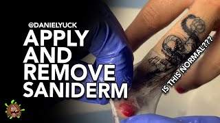 Applying And Removing Saniderm Is This Normal [upl. by Lerrehs942]