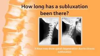 Health and Chiropractic Facts  Chiropractic Adjustments [upl. by Ruckman]