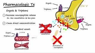 Migraines  Pathophysiology amp Treatment Described Concisely [upl. by Giana]