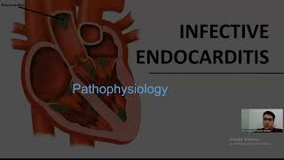 infective endocarditis  part 1   تم اضافة ال power point [upl. by Stortz]