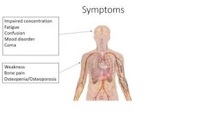 Unexplained Hypercalcaemia  Diagnosis and Management [upl. by Christel]