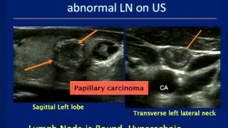 Thyroid Ultrasound Course [upl. by Greenwell]