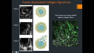 Multiphoton  In Vivo Imaging of the Tumor Microenvironment of Breast Cancer  Bruker [upl. by Imoen]