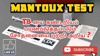 MANTOUX TEST  USES  METHOD  PROCEDURE  PHARMA TAMIL  AKI 46 [upl. by Ahsytal344]