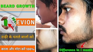 BEARD GROWTH  FROM EVION 400 □ Best beard growth soulation  दाढ़ी को मोटा और काला कैसे करें [upl. by Yablon]