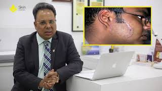 Fungal Infection Epidemic By Dr Koushik Lahiri  Skin diaries [upl. by Dannie]