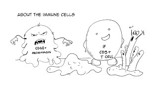 Muscle Abnormalities Worsen in Post Exertional Malaise [upl. by Enaywd749]