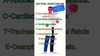 VACTERL ASSOCIATION [upl. by Drofwarc]