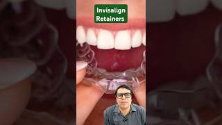 Invisalign retainer shortsviral shortvideo shorts short [upl. by Delia]