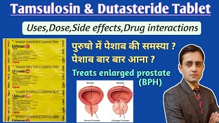 Tamsulosin hydrochloride and dutasteride tablet uses dose side effects in hindi  Urimax d tablet [upl. by Ahsemot]