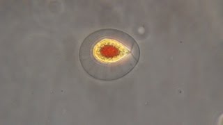 Haematococcus pluvialis the green algae that turn red [upl. by Chitkara]