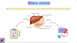 Understanding Biliary Atresia – Causes Diagnosis and Treatment [upl. by Ynohtnaleahcim]