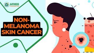 Understanding NonMelanoma Skin Cancer Causes Symptoms and Treatment Options [upl. by Giff115]