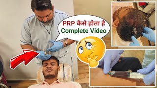 PRP Hair Loss Treatment Before And After Results GFC Hair Treatment Results Before And After Raipur [upl. by Bergerac]