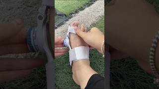 Part 146 bigfootboneprotrusion thumbvalgus separate toesviralvideoytshorts [upl. by Enalb]