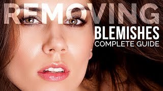 Complete Guide to Removing Blemishes in Photoshop [upl. by Ihab778]