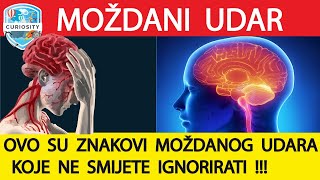 Moždani udar vrste uzroci simptomi liječenje Dr120 [upl. by Pris]