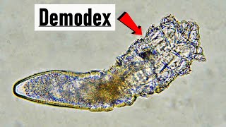 Live Demodex canis mite under microscope  10x magnification [upl. by Eerhs]