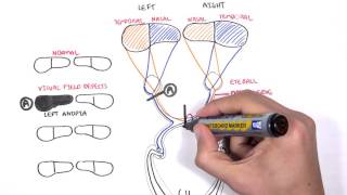 Visual Pathway and Lesions [upl. by Patterman191]